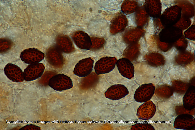 Helicon focus e spore di.. (??) (Lacrymaria velutina)